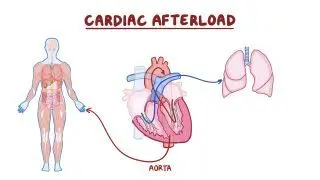 Cardiac afterload
