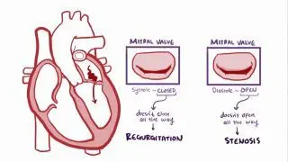 Mitral valve disease
