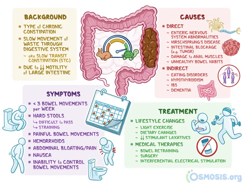Lazy Bowel Syndrome: What Is It, Causes, Treatment, and More | Osmosis
