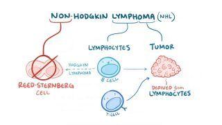 Non-Hodgkin lymphoma