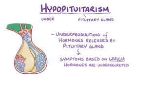 Hyperpituitarism and hypopituitarism Notes: Diagrams & Download PDF ...