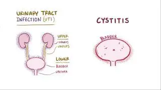 Interstitial Cystitis: What Is It, Causes, Signs, Symptoms, and More |  Osmosis