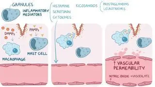 Inflammation