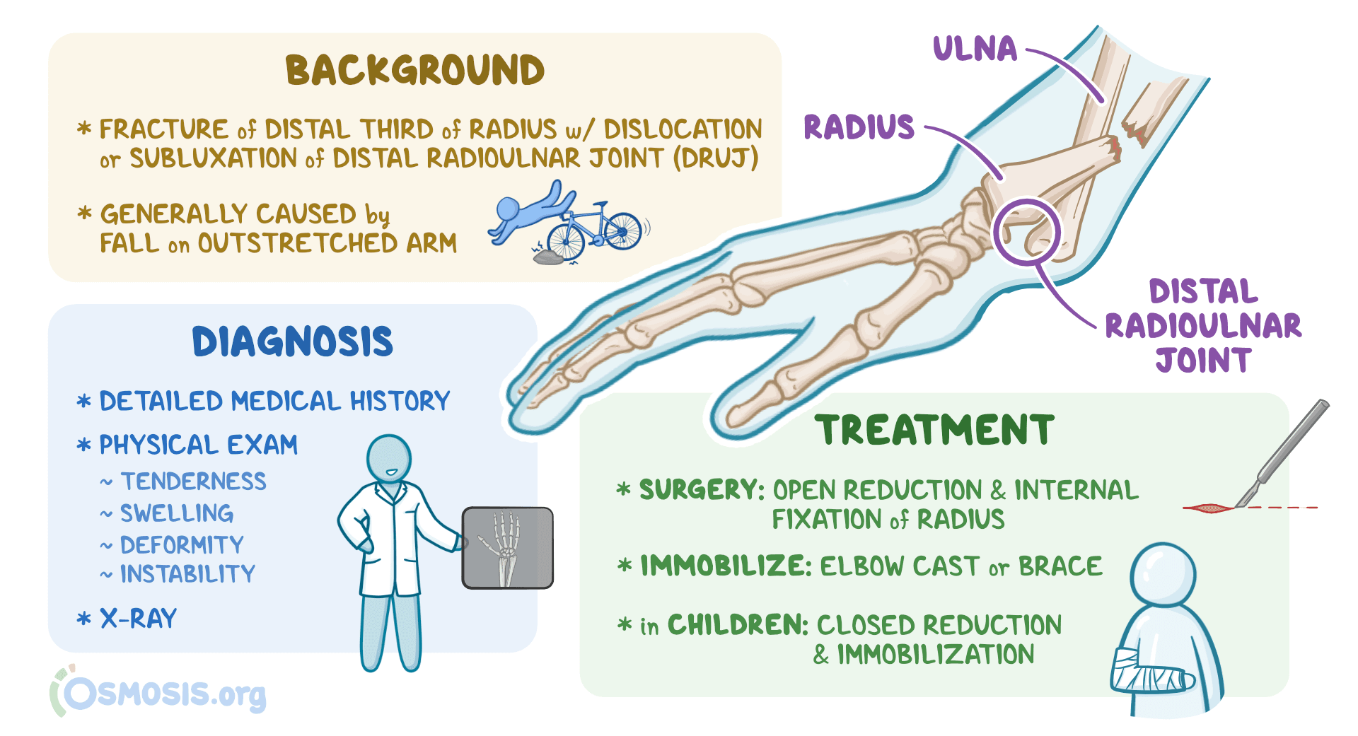 An infographic detailing Galeazzi fractures.