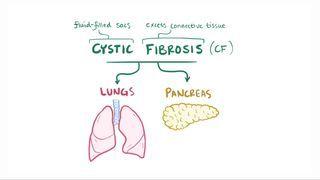 Cystic fibrosis