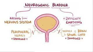 Bladder pathology Notes: Diagrams & Download PDF | Osmosis