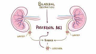 Postrenal azotemia