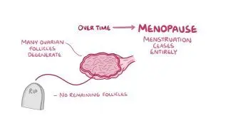 Menopause