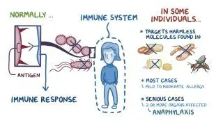 Anaphylaxis