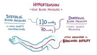 Hypertension