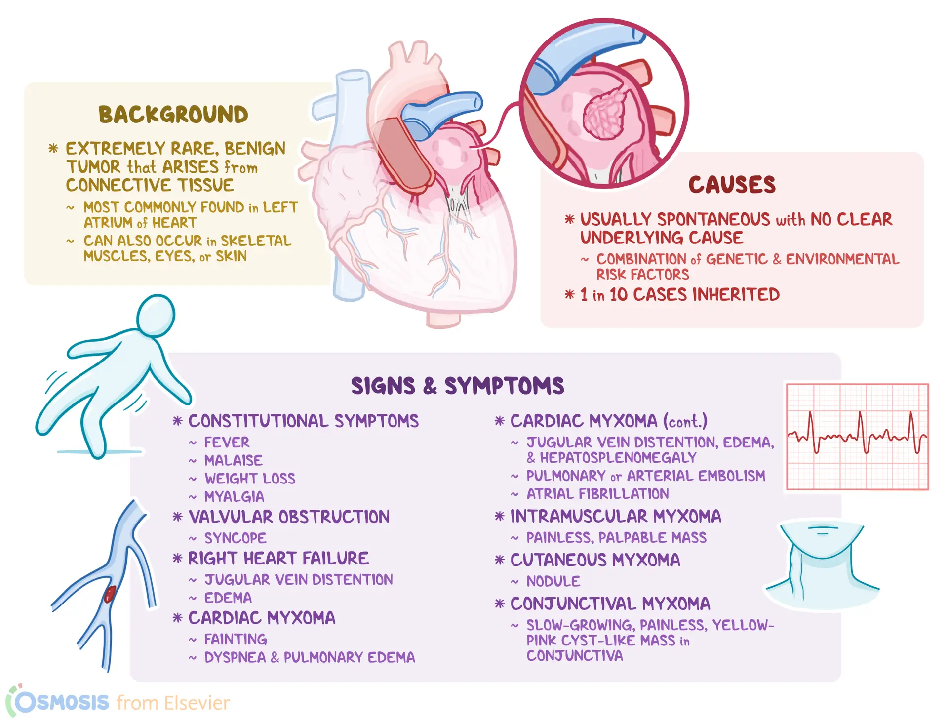 An infographic detailing myxoma.