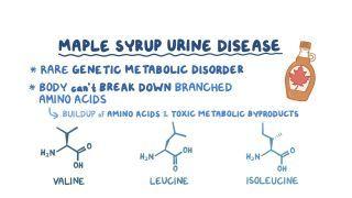 Maple syrup urine disease
