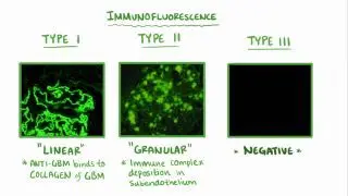 Rapidly progressive glomerulonephritis