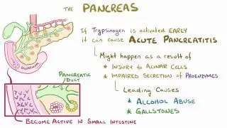 Acute pancreatitis