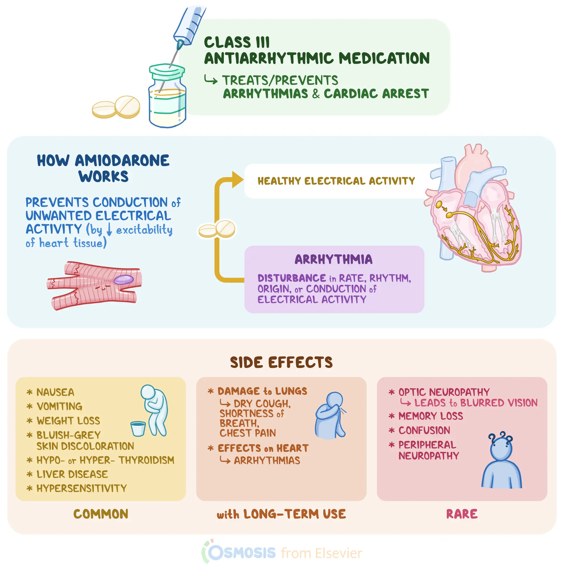 An infographic detailing amiodarone