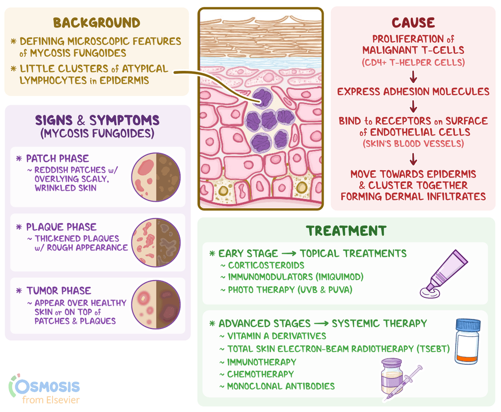 An Infographic detailing pautrier microabscesses