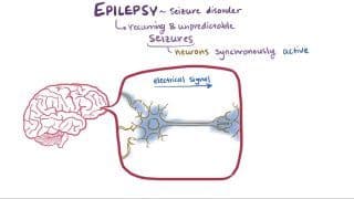 Epilepsy and seizures Notes: Diagrams & Download PDF | Osmosis
