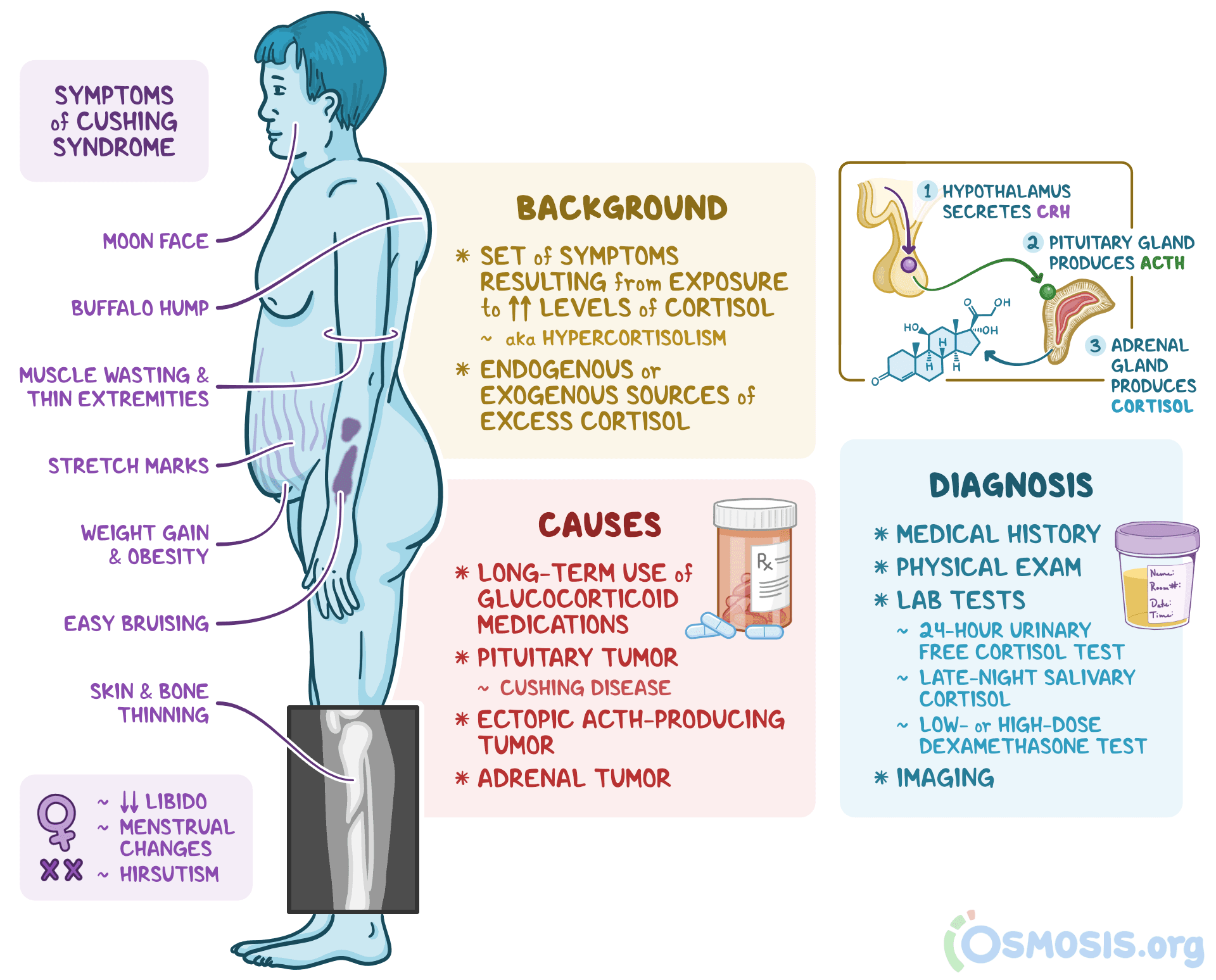 An infographic detailing Cushing syndrome.