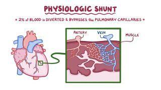 Pulmonary shunts