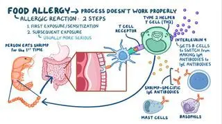 Food allergy