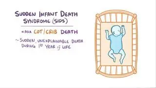 Sudden infant death syndrome