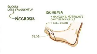Necrosis and apoptosis