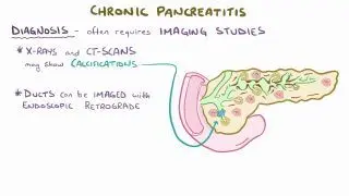 Chronic pancreatitis