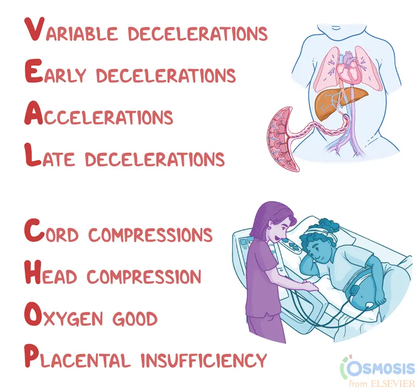 VEAL CHOP: Fetal Heart Rate Patterns Mnemonic | Osmosis