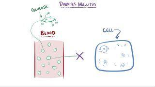 Diabetes mellitus