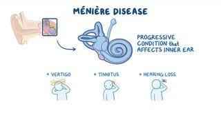 Meniere disease: Nursing: Video & Causes