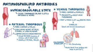 Antiphospholipid syndrome