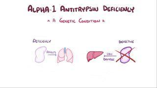 Alpha 1-antitrypsin deficiency