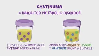Cystinuria (NORD)