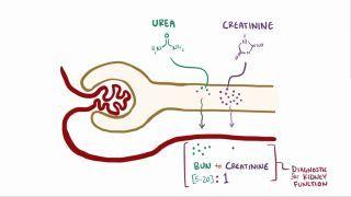 Renal azotemia