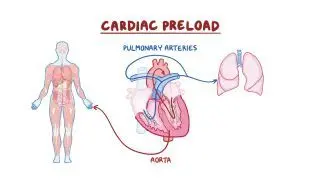 Cardiac preload
