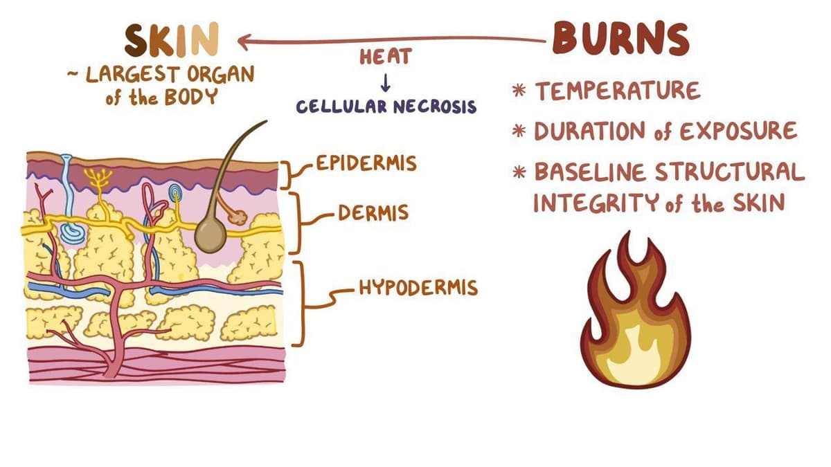 Burns: Clinical: Video, Anatomy, Definition & Function | Osmosis