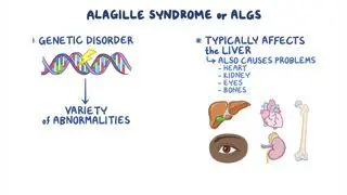 Alagille syndrome (NORD)