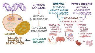 Glycogen storage disease type II (NORD)