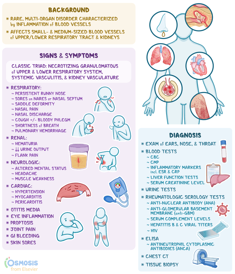 An infographic detailing granulomatosis with polyangiitis