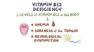 Vitamin B12 deficiency