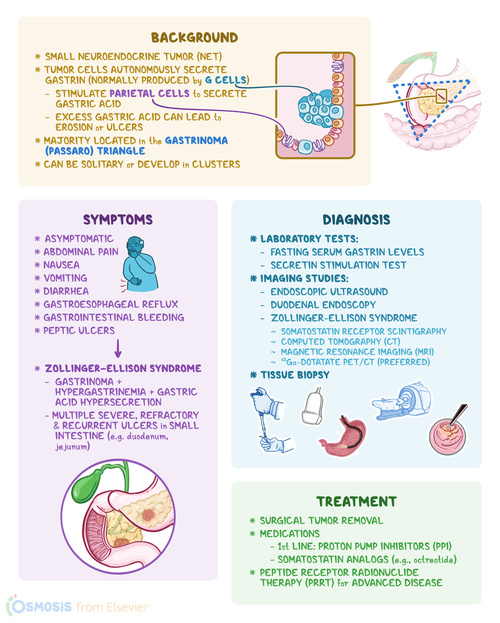 An infographic detailing the background of gastrinoma.