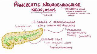 Pancreatic neuroendocrine neoplasms
