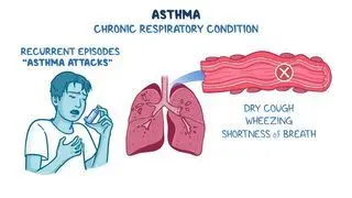 Asthma