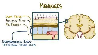 Subarachnoid hemorrhage