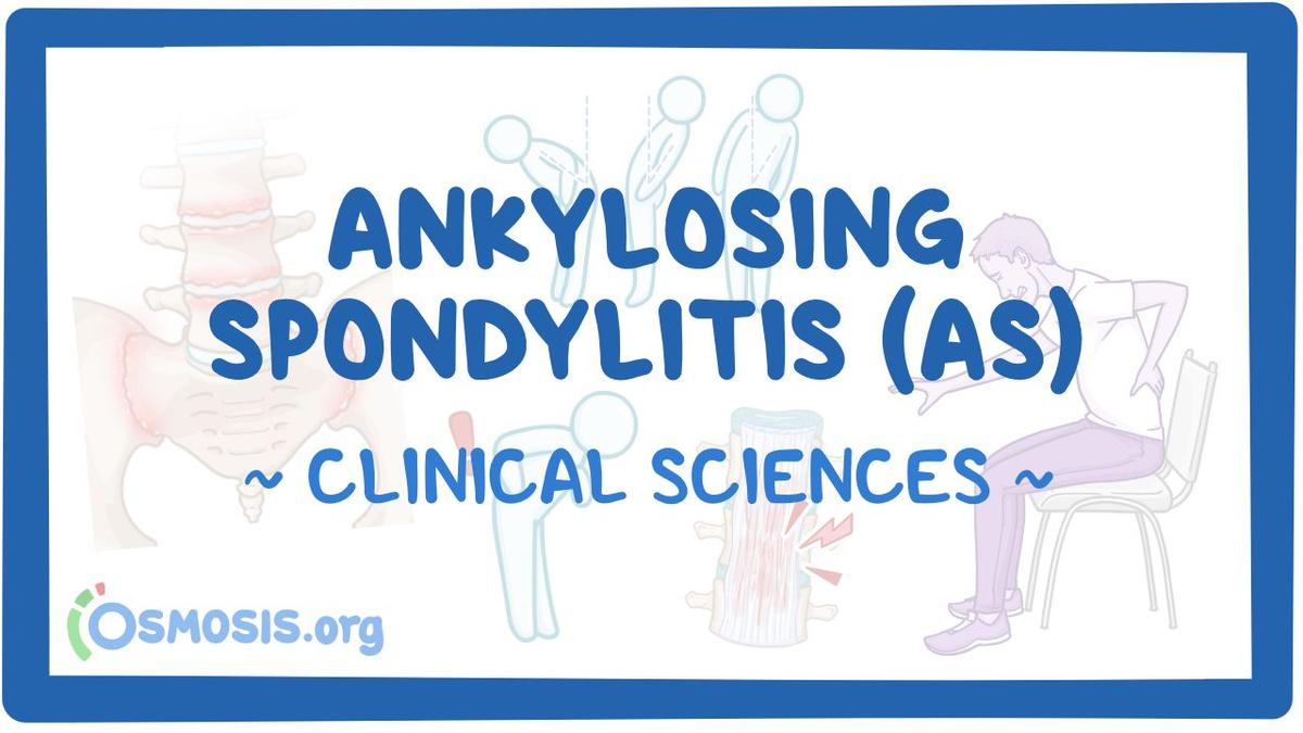 Ankylosing spondylitis: Video & Meaning | Osmosis