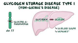 Glycogen storage disease type I