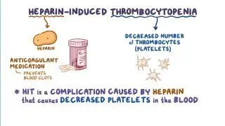 Heparin-induced thrombocytopenia