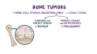 Bone tumors