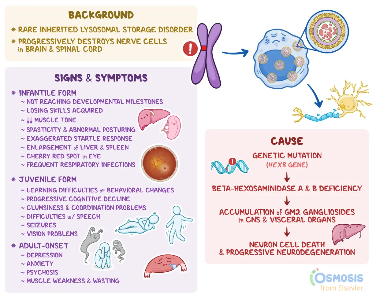 An infographic detailing Sandhoff disease.