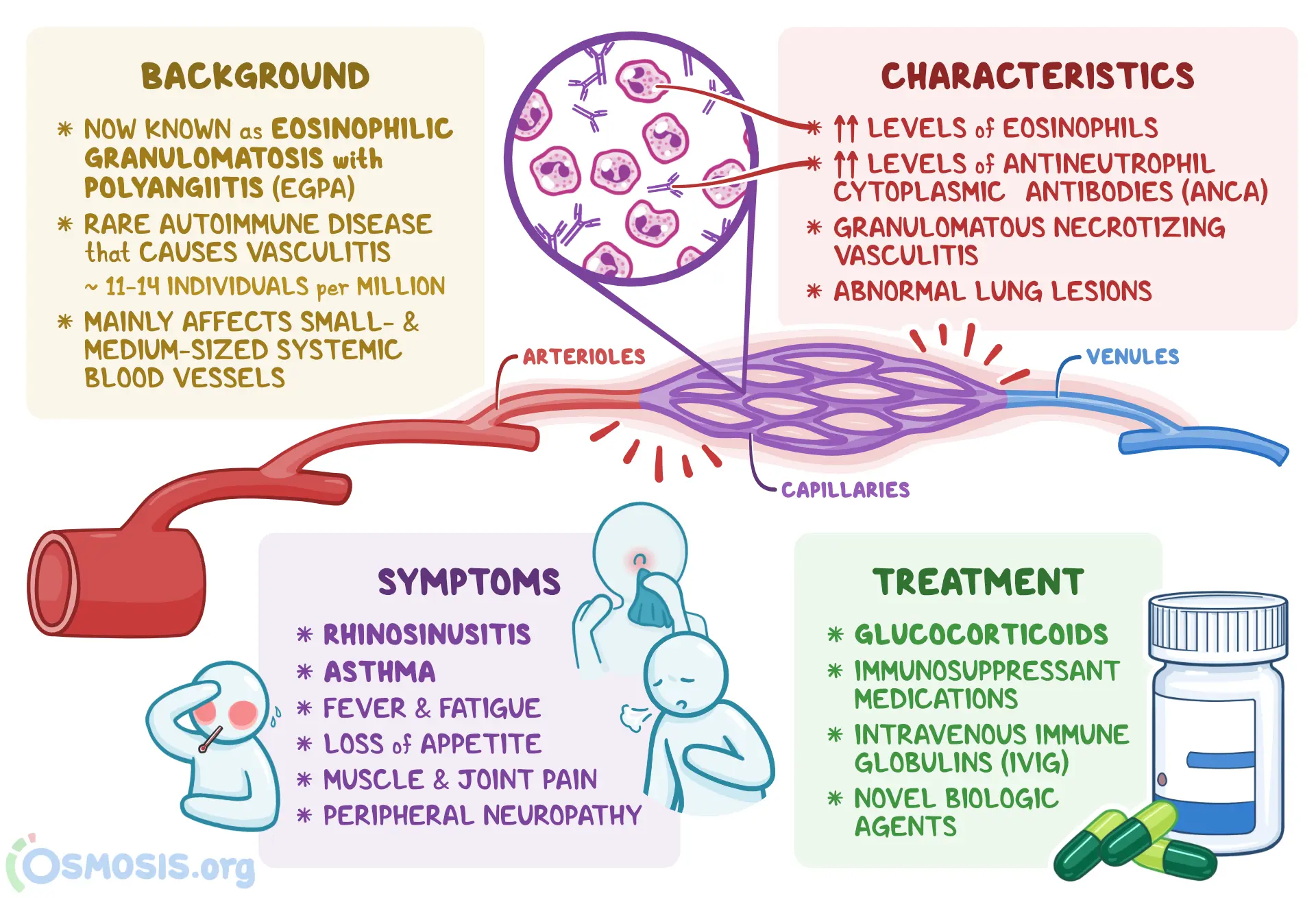 An infographic detailing the causes, signs and symptoms, diagnosis, and treatment of Churg-Strauss Syndrome